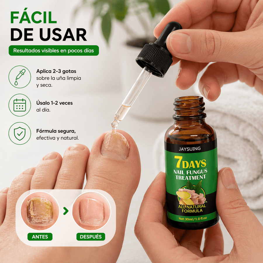 Tratamiento Antihongos para Uñas – Reparación y Cuidado Intensivo